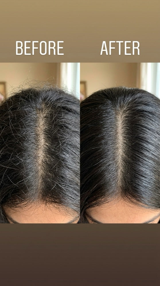 Maya Hair Oil before and after — scalp
