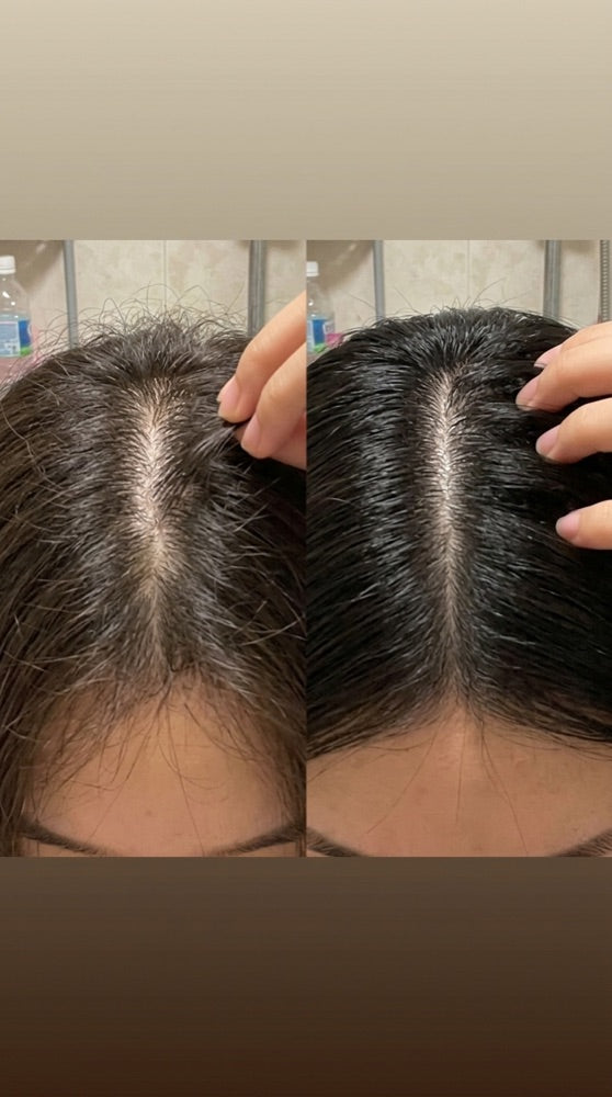 Maya Hair Oil before and after — scalp thickness