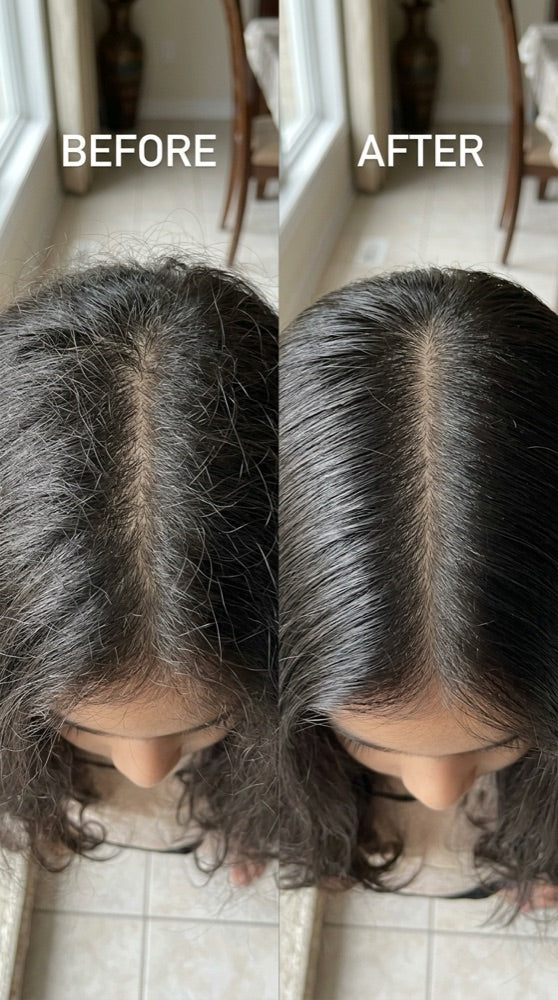 Maya Hair Oil before and after — scalp result